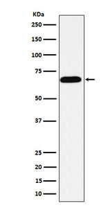 Anti-Alkaline phosphatase ALPI Rabbit Monoclonal Antibody Boster Bio