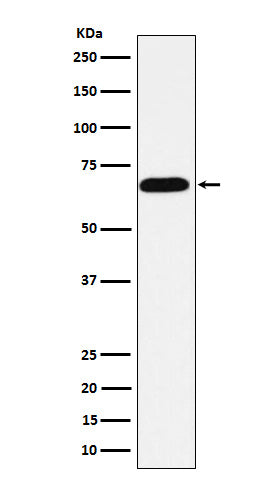 Anti-Alkaline phosphatase ALPI Rabbit Monoclonal Antibody Boster Bio
