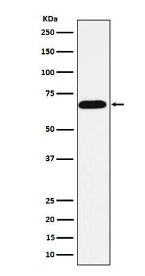 Anti-Alkaline phosphatase ALPI Rabbit Monoclonal Antibody Boster Bio