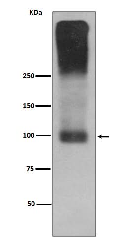 Anti-mGluR2 GRM2 Rabbit Monoclonal Antibody Boster Bio