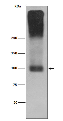 Anti-mGluR2 GRM2 Rabbit Monoclonal Antibody Boster Bio