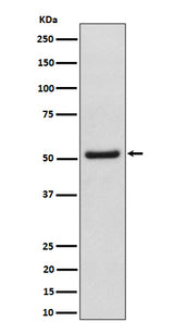 Anti-NUP50 Rabbit Monoclonal Antibody Boster Bio