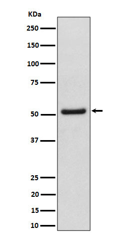 Anti-NUP50 Rabbit Monoclonal Antibody Boster Bio