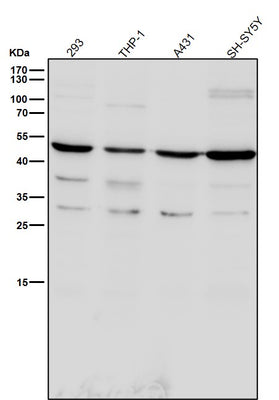 Anti-TROY Rabbit Monoclonal Antibody Boster Bio