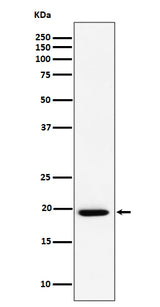 Anti-UFC1 Rabbit Monoclonal Antibody Boster Bio