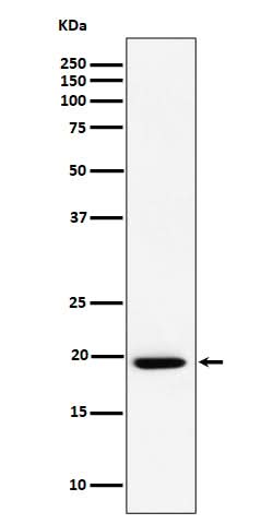 Anti-UFC1 Rabbit Monoclonal Antibody Boster Bio