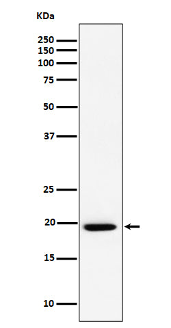 Anti-UFC1 Rabbit Monoclonal Antibody Boster Bio