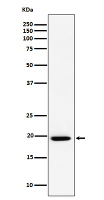 Anti-UFC1 Rabbit Monoclonal Antibody Boster Bio