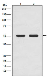 Anti-AP2M1/Ap 2 Mu 1 Rabbit Monoclonal Antibody Boster Bio