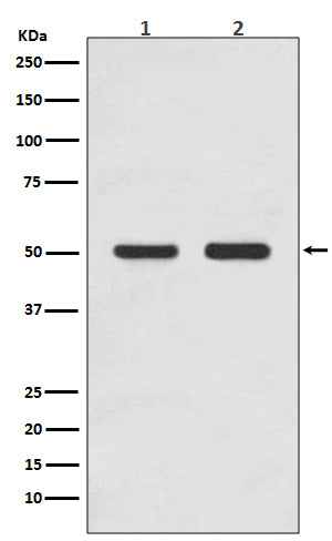 Anti-AP2M1/Ap 2 Mu 1 Rabbit Monoclonal Antibody Boster Bio