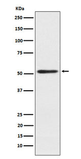 Anti-SRP54 Rabbit Monoclonal Antibody Boster Bio