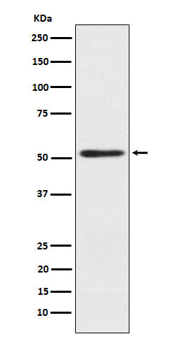 Anti-SRP54 Rabbit Monoclonal Antibody Boster Bio