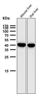Anti-SEC14L2 / TAP Rabbit Monoclonal Antibody Boster Bio