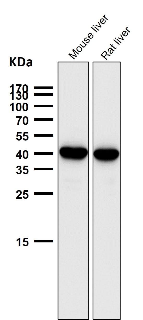 Anti-SEC14L2 / TAP Rabbit Monoclonal Antibody Boster Bio