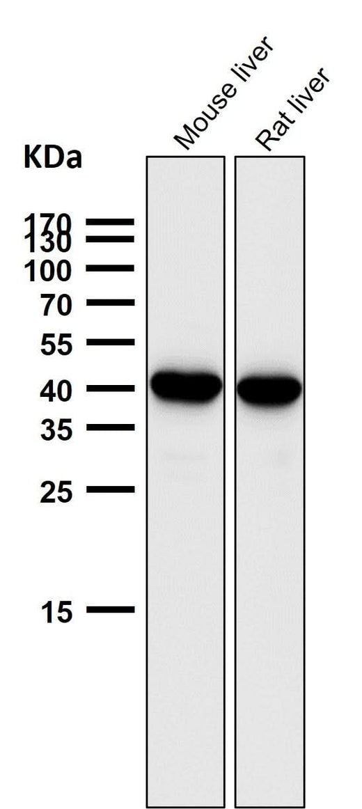 Anti-SEC14L2 / TAP Rabbit Monoclonal Antibody Boster Bio