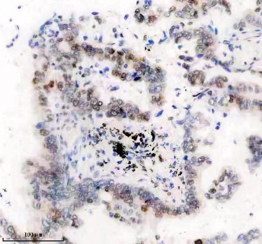 Anti-Histone H1.2 Monoclonal Antibody Boster Bio