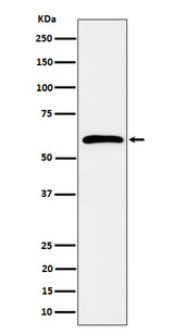 Anti-Syndecan 3 Rabbit Monoclonal Antibody Boster Bio