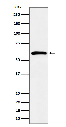Anti-Syndecan 3 Rabbit Monoclonal Antibody Boster Bio