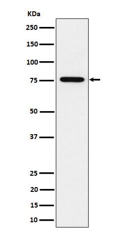 Anti-BRAT1 Rabbit Monoclonal Antibody Boster Bio