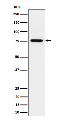 Anti-BRAT1 Rabbit Monoclonal Antibody Boster Bio