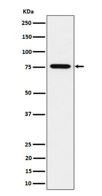 Anti-BRAT1 Rabbit Monoclonal Antibody Boster Bio
