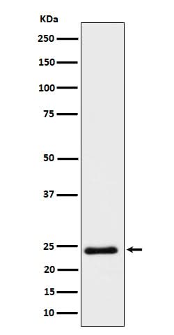 Anti-Mras Rabbit Monoclonal Antibody Boster Bio