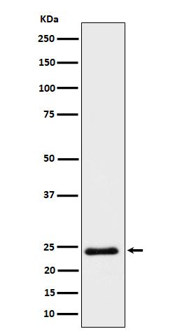 Anti-Mras Rabbit Monoclonal Antibody Boster Bio