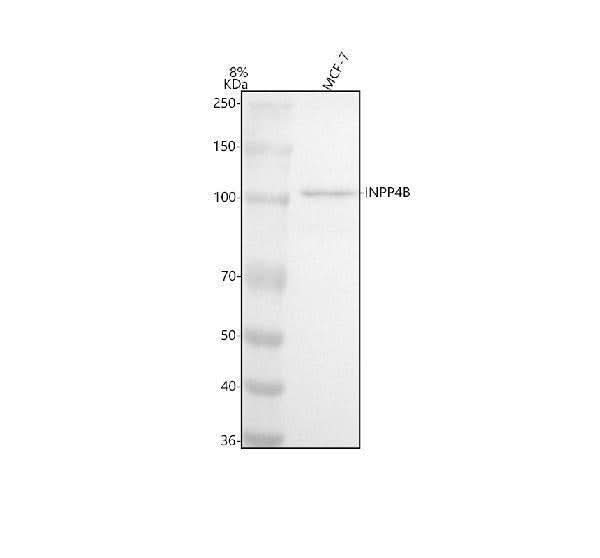 Anti-INPP4B/Type Ii 4 Phosphatase Rabbit Monoclonal Antibody Boster Bio