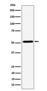 Anti-NPY5R Rabbit Monoclonal Antibody Boster Bio