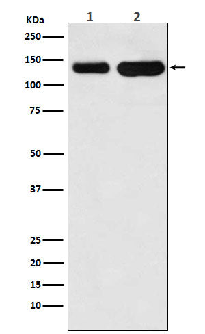 Anti-K-Cadherin-6 CDH6-Monoclonal Antibody Boster Bio