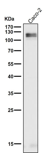 Anti-LI-Cadherin-17 CDH17-Rabbit Monoclonal Antibody Boster Bio
