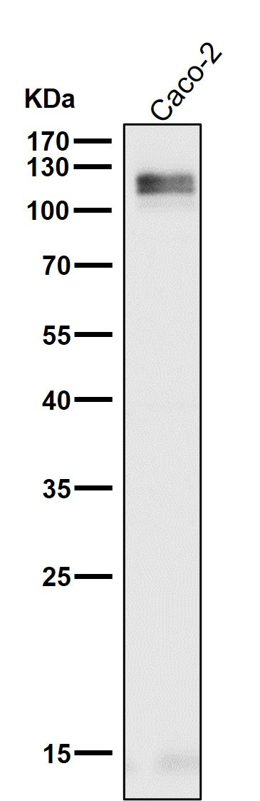 Anti-LI-Cadherin-17 CDH17-Rabbit Monoclonal Antibody Boster Bio