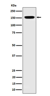 Anti-NUP155 Rabbit Monoclonal Antibody Boster Bio