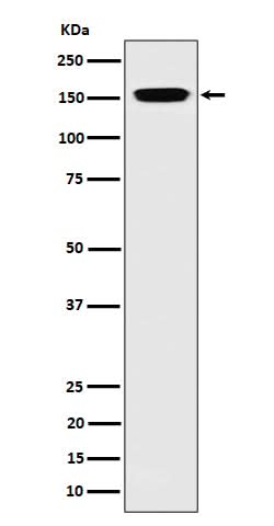 Anti-NUP155 Rabbit Monoclonal Antibody Boster Bio