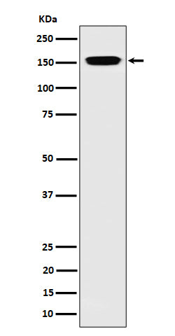 Anti-NUP155 Rabbit Monoclonal Antibody Boster Bio