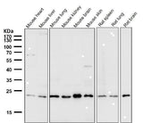 Anti-VPS28 Rabbit Monoclonal Antibody Boster Bio