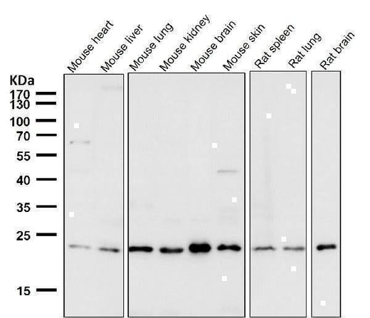Anti-VPS28 Rabbit Monoclonal Antibody Boster Bio