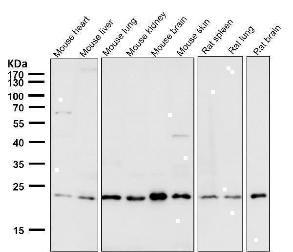 Anti-VPS28 Rabbit Monoclonal Antibody Boster Bio