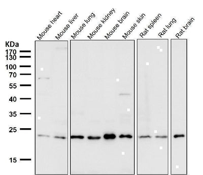 Anti-VPS28 Rabbit Monoclonal Antibody Boster Bio