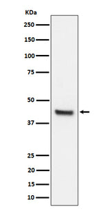 Anti-IL11RA Rabbit Monoclonal Antibody Boster Bio