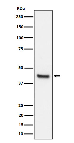 Anti-IL11RA Rabbit Monoclonal Antibody Boster Bio