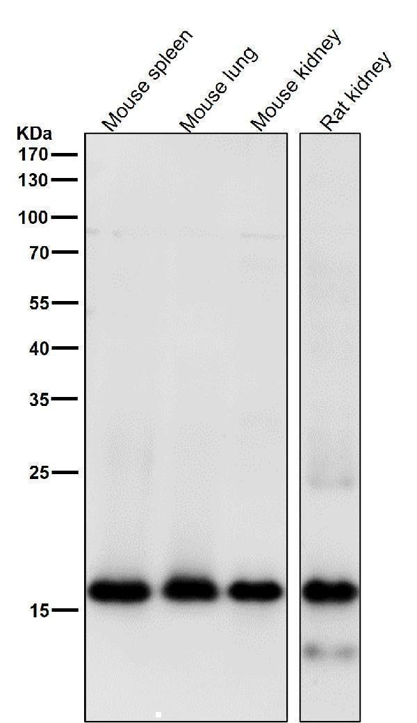 Anti-MYL9 Rabbit Monoclonal Antibody Boster Bio