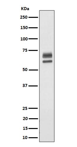 Anti-PPP2R5D Rabbit Monoclonal Antibody Boster Bio