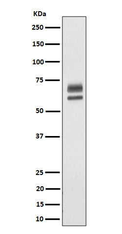 Anti-PPP2R5D Rabbit Monoclonal Antibody Boster Bio
