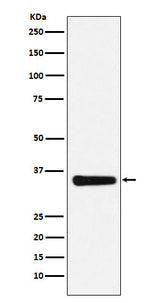 Anti-MED4 Rabbit Monoclonal Antibody Boster Bio