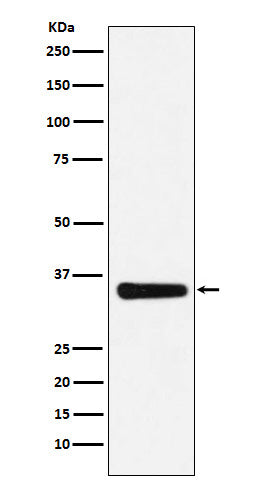 Anti-MED4 Rabbit Monoclonal Antibody Boster Bio