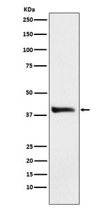 Anti-Alcohol Dehydrogenase Rabbit Monoclonal Antibody Boster Bio
