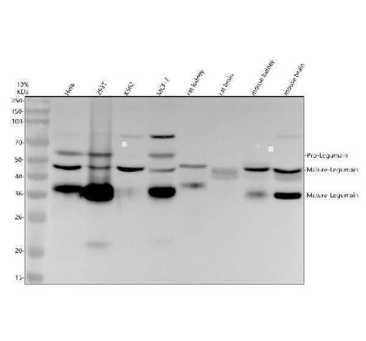 Anti-Legumain Rabbit Monoclonal Antibody Boster Bio