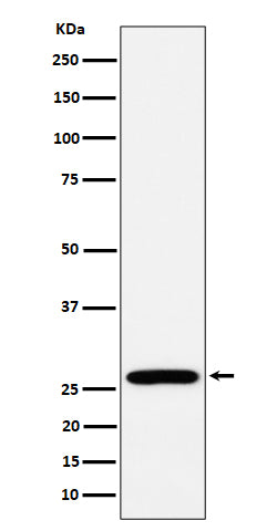 Anti-RPL13 Rabbit Monoclonal Antibody Boster Bio