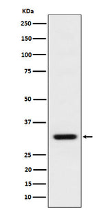 Anti-BCL2L12 Rabbit Monoclonal Antibody Boster Bio